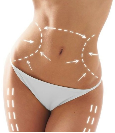 mesoterapia