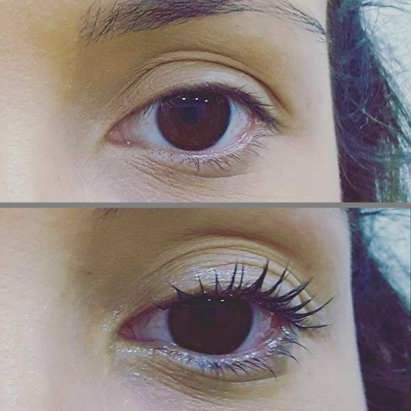 antesdepois