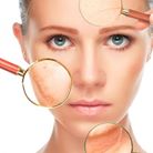 fotorejuvenescimento