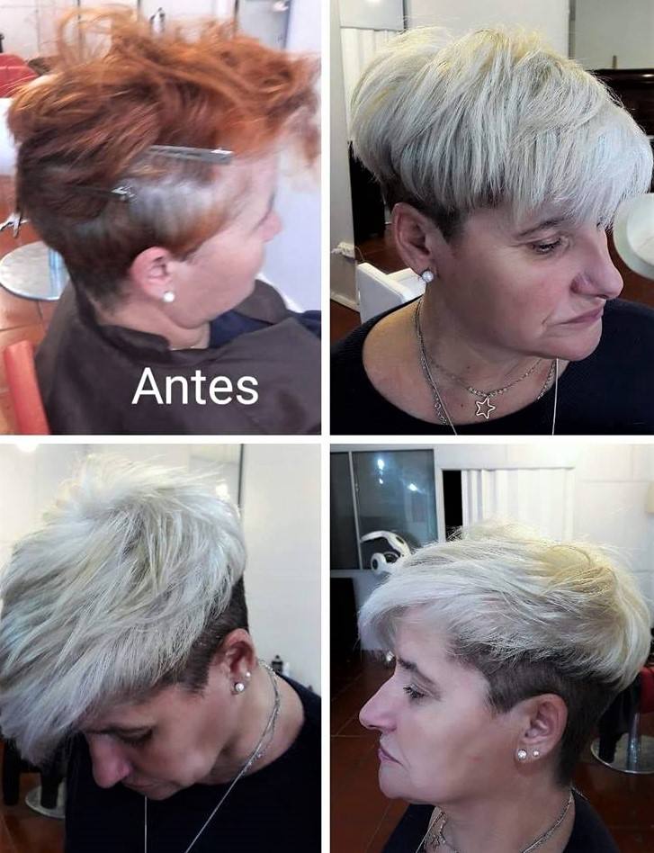 antesedepois